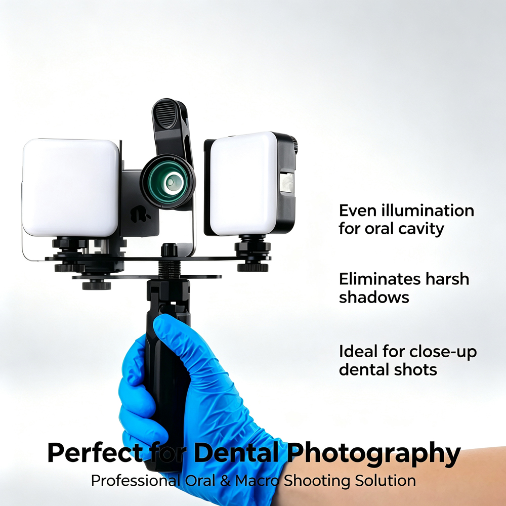 LODDEN Luz de relleno Dental c - Photography Lighting With Flash reseña y precio