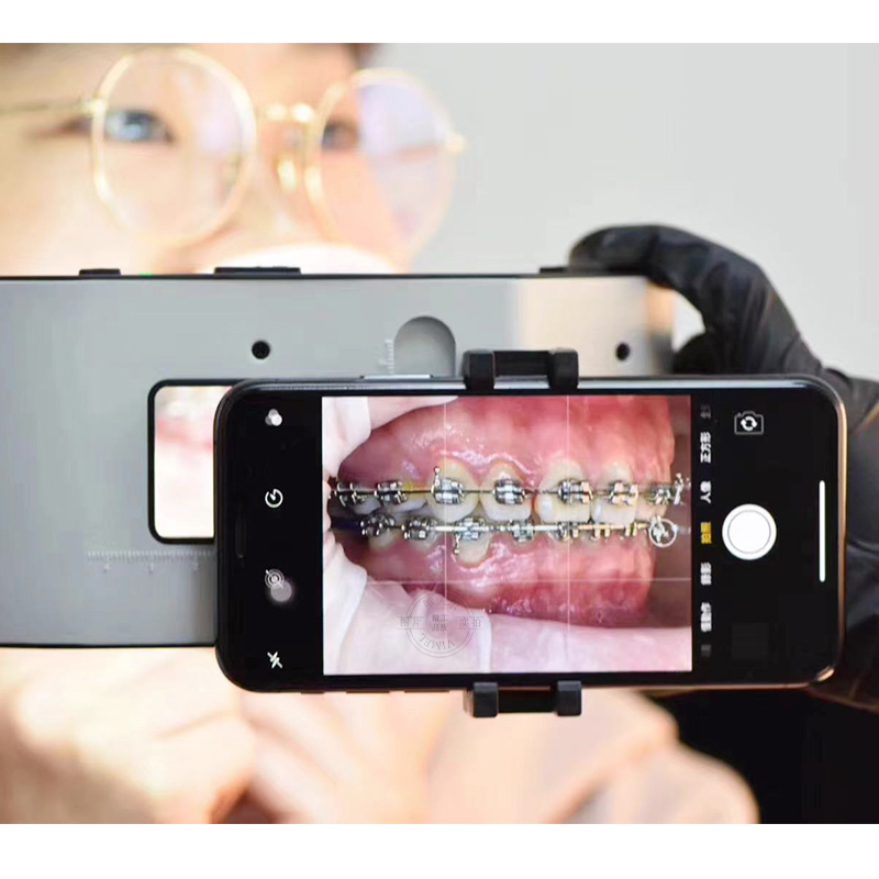 Nueva Lámpara Dental con Sopor - Photography Lighting With Flash reseña y precio